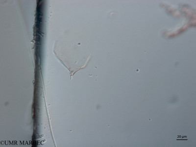 phyto/Brazilian_Nordeste/Seamounts_station60/ABRACOS2 April 2017/Rhizosolenia castracanei (Snap-545)(copy)_thumb.jpg